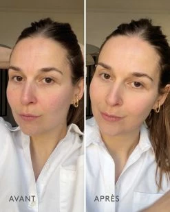 Poudre Minérale SPF20 -Dermalogica Soldes Avant apres2