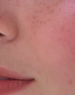 Bisou Blush Crème -Dermalogica Soldes Captured ecran2023 07 06a11.26.31